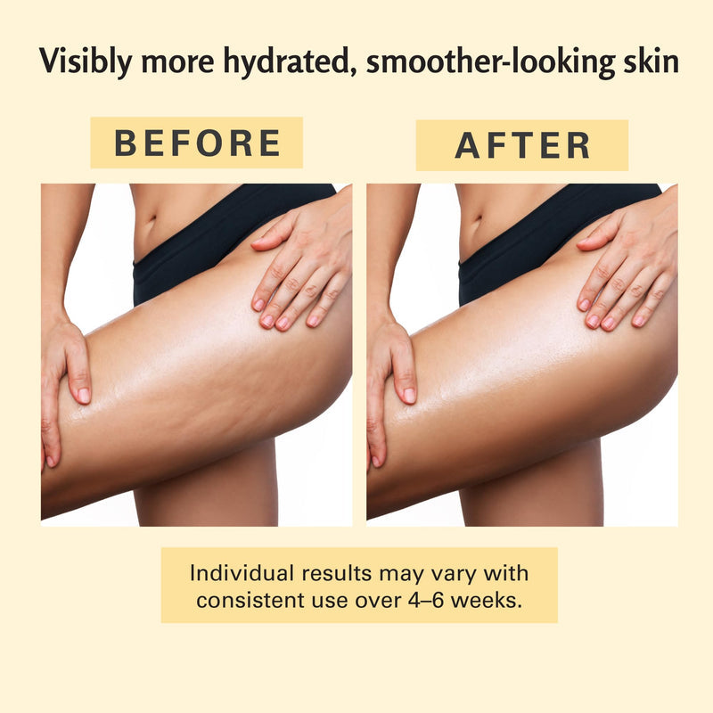 Anti-Cellulite Lymphatic Drainage Massager & Collagen Body Oil Set